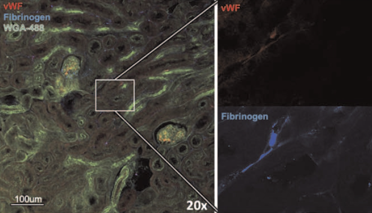 Biological Response to Trauma